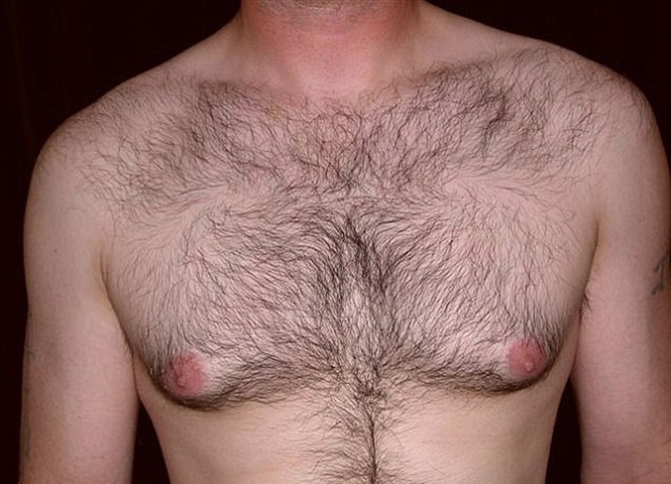 мало волос на груди у мужчин фото 77